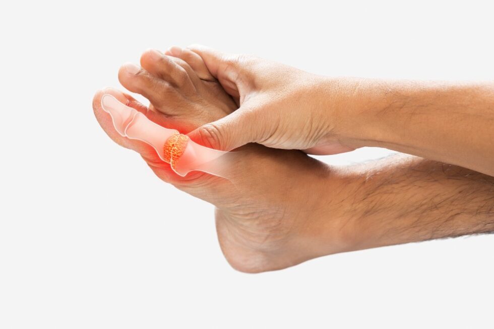 Big Toe Joint Pain Foot & Ankle Associates of Greater Pittsburgh