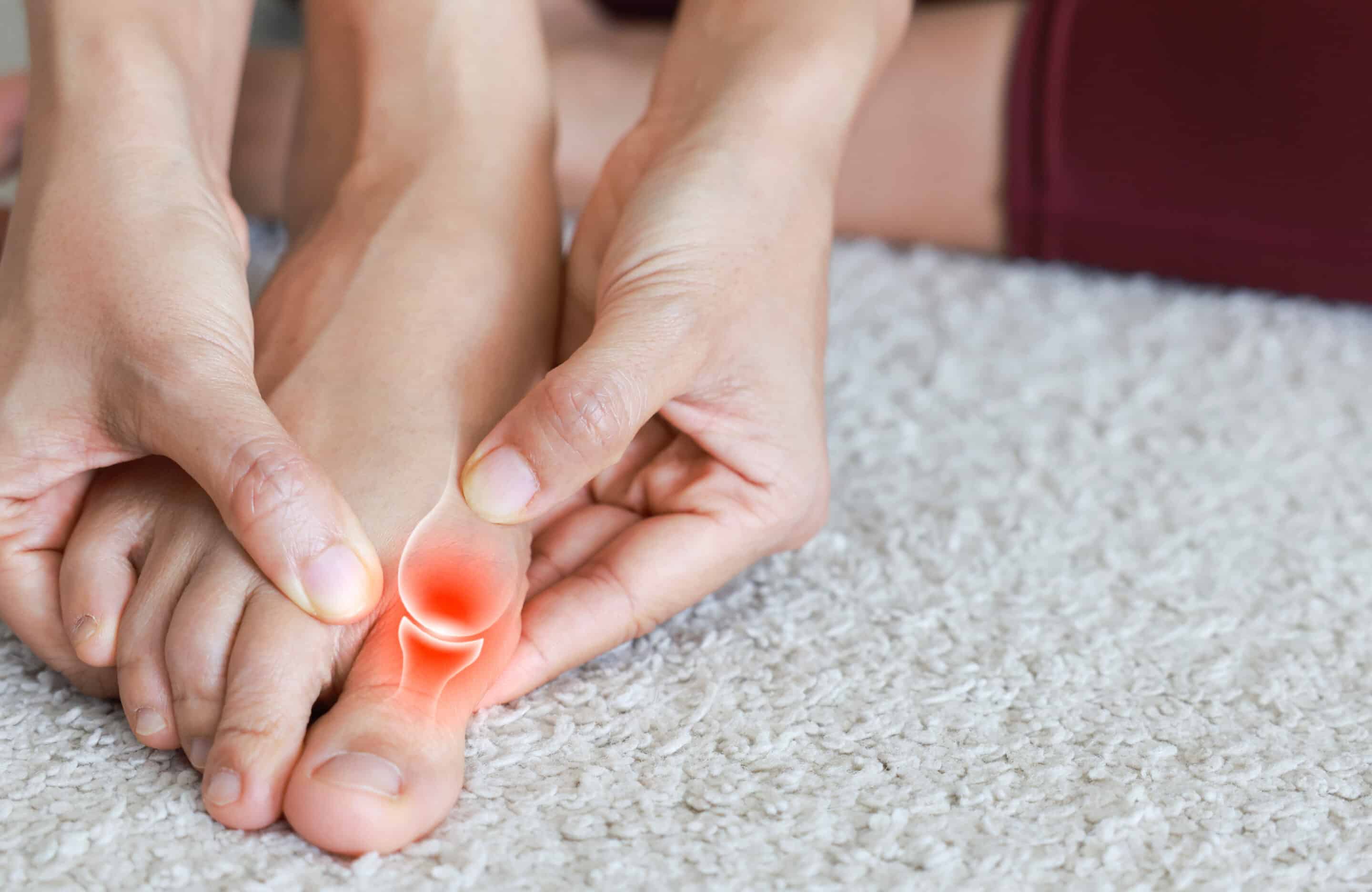 Woman massaging her toe with bunion